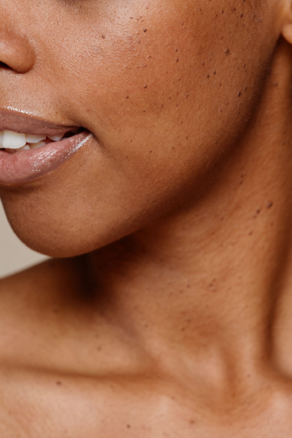 BOTIK SKIN CORRECTProtocolo corretivo e uniformizador. Ideal para peles mistas a oleosas ou com com manchas e marcas de acne, regula a oleosidade e atenua imperfeições de forma segura e progressiva